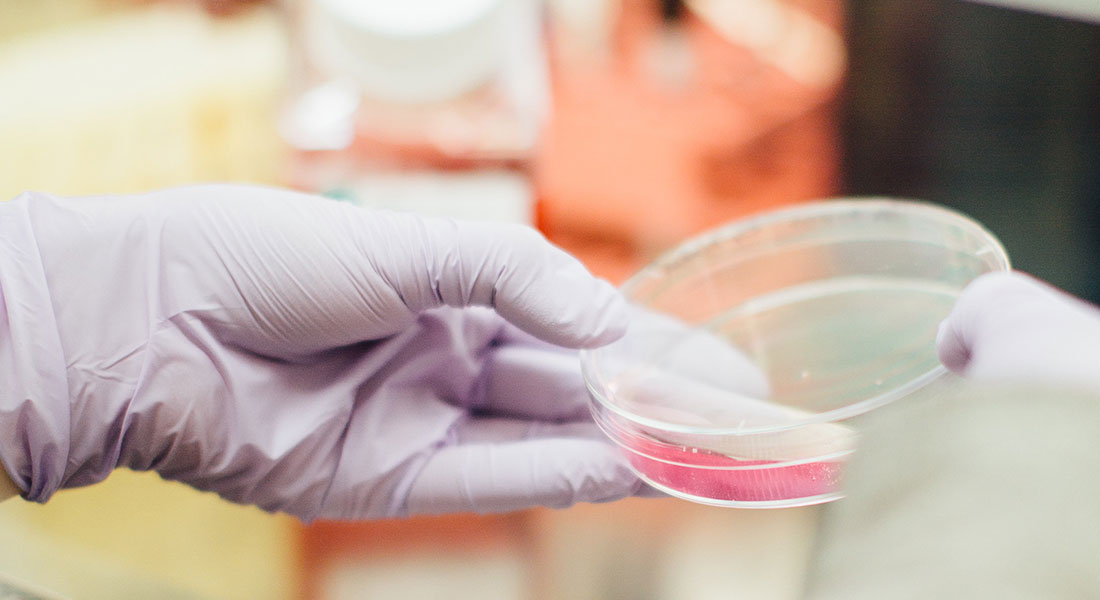 Promega - la carne coltivata può aiutare a combattere la crisi alimentare 3