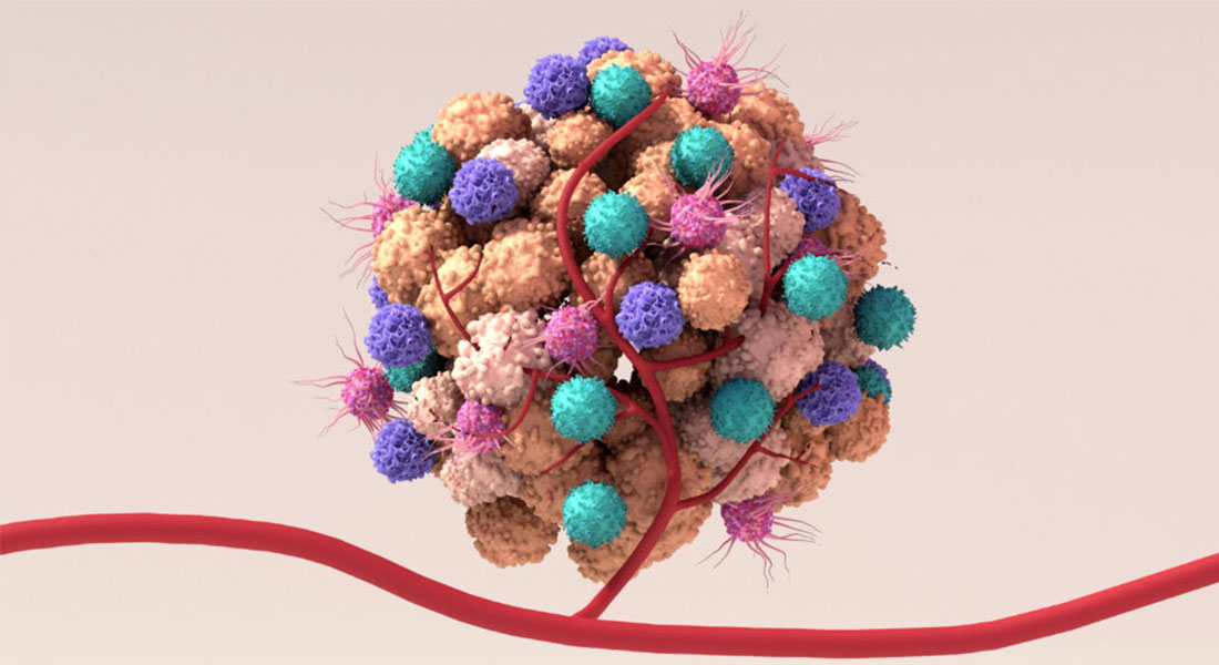 Promega Lab Blog - Crosstalk tra cellule nervose e tumore nel microambiente tumorale 1