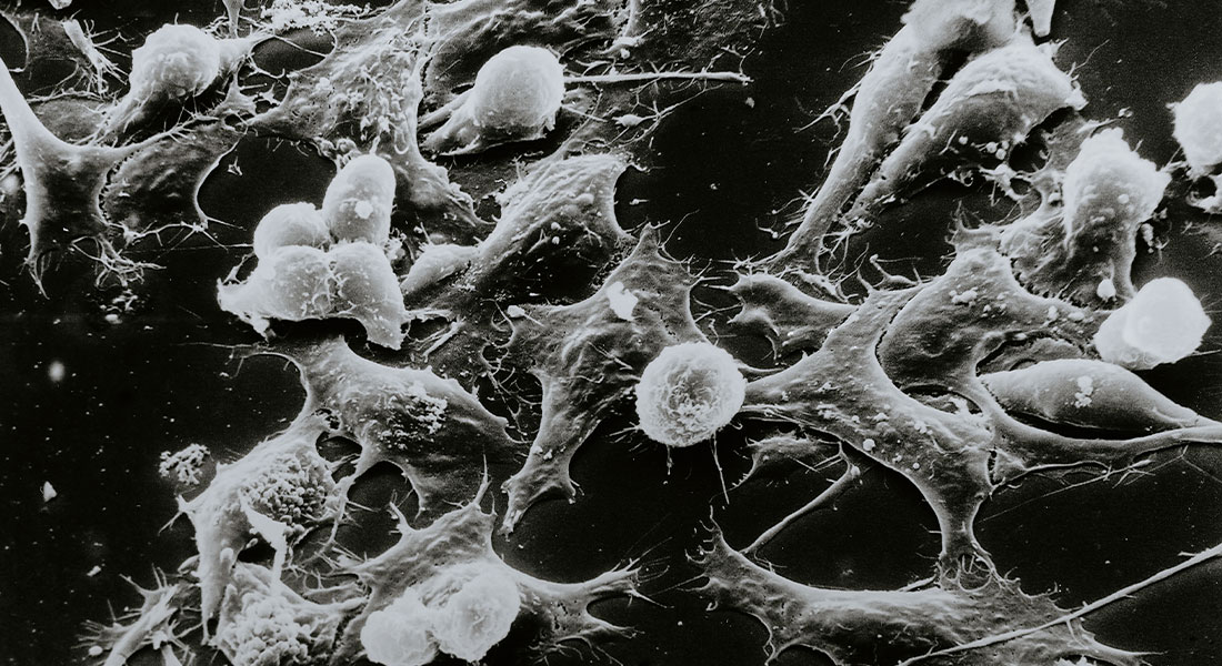 Promega Lab Blog - Crosstalk tra cellule nervose e tumore nel microambiente tumorale 2