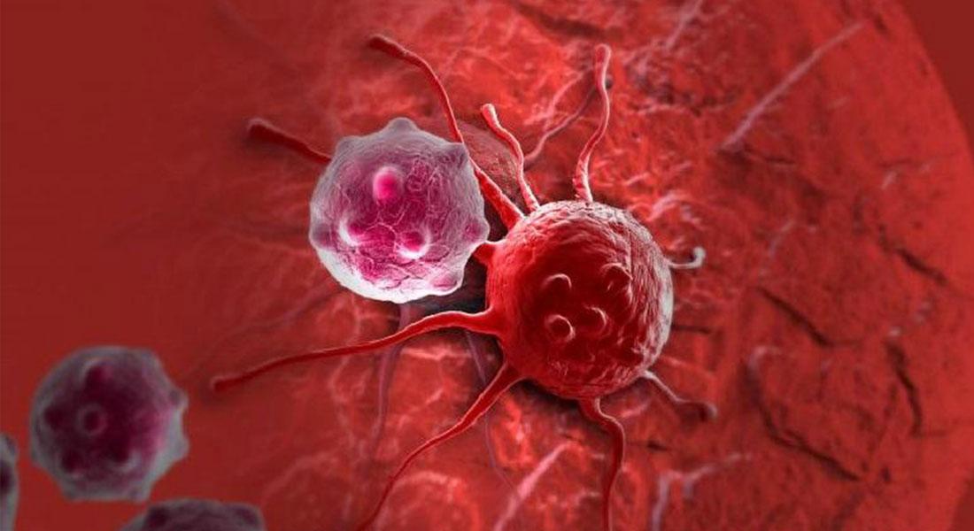 blog-glioblastoma1