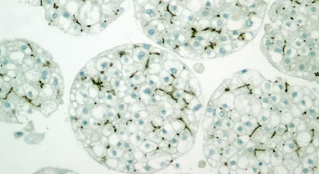 Promega LabBlog - Steatosi epatica non alcolica (NAFLD): cos'è è perché monitorare il metabolismo cellulare aiuta la ricerca 2