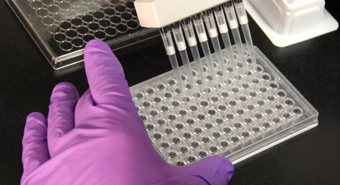 Promega LabBlog - Steatosi epatica non alcolica (NAFLD): cos'è è perché monitorare il metabolismo cellulare aiuta la ricerca 3