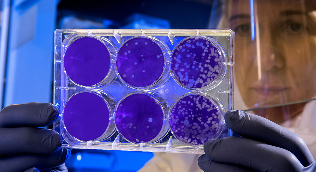 Promega Lab Blog - Senescenza cellulare e terapie oncologiche: superare l'immortalità 3