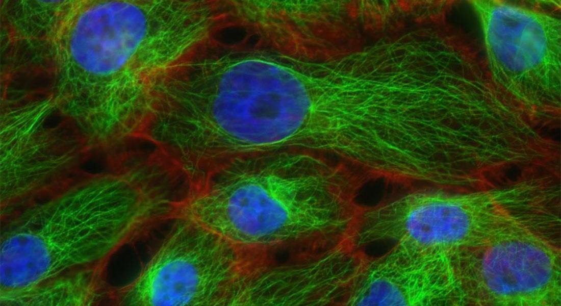 Promega-lab-blog-variante-genetica-2