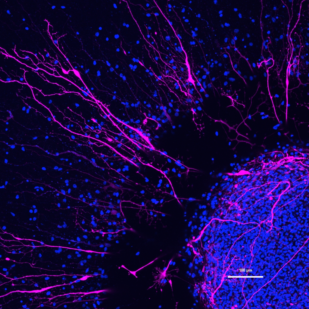 45-days-neurospheres-scale-bar