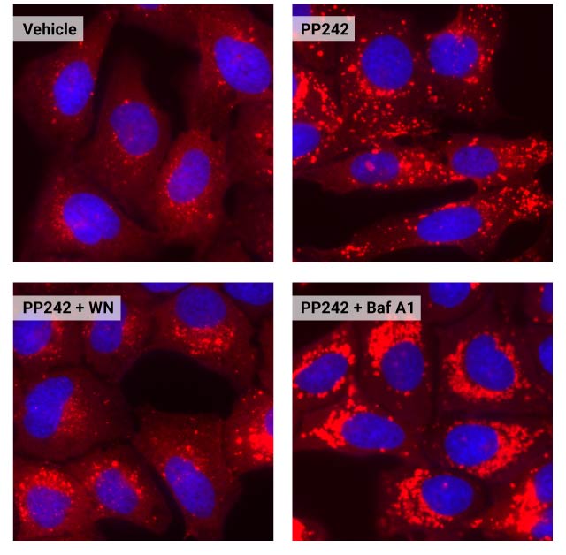 how to measure autophagy autophagosome imaging