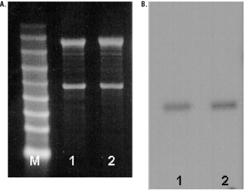 Analysis of total RNA from mouse and rat brains.