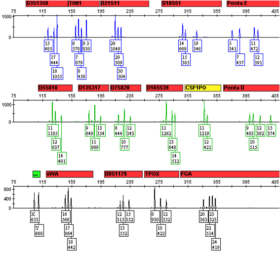 A 1:1 mixture of DNA from two sources.